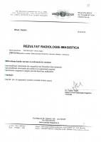 /album/rezultate-medicale/a2010-irm-coloana-lombo-sacrata-jpg/